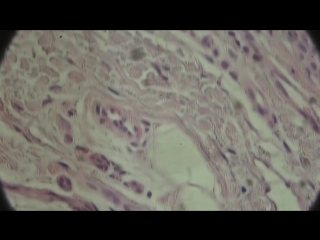 ЧТО БУДЕТ ЕСЛИ ИЗГОТОВИТЬ ЧЕЛОВЕЧЕСКУЮ КОЖУ